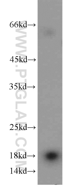 WB analysis of mouse kidney using 15136-1-AP