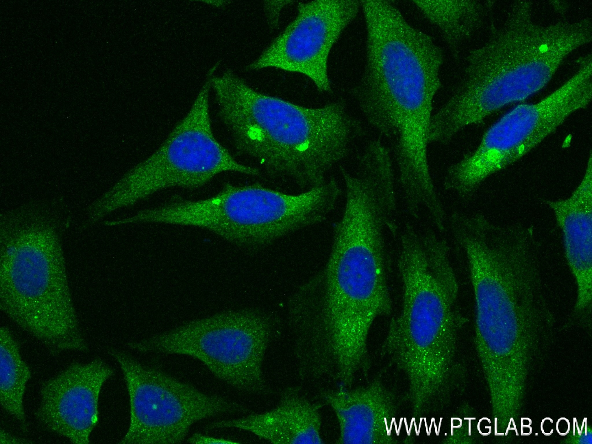 Immunofluorescence (IF) / fluorescent staining of HeLa cells using NME3 Recombinant antibody (84278-6-RR)