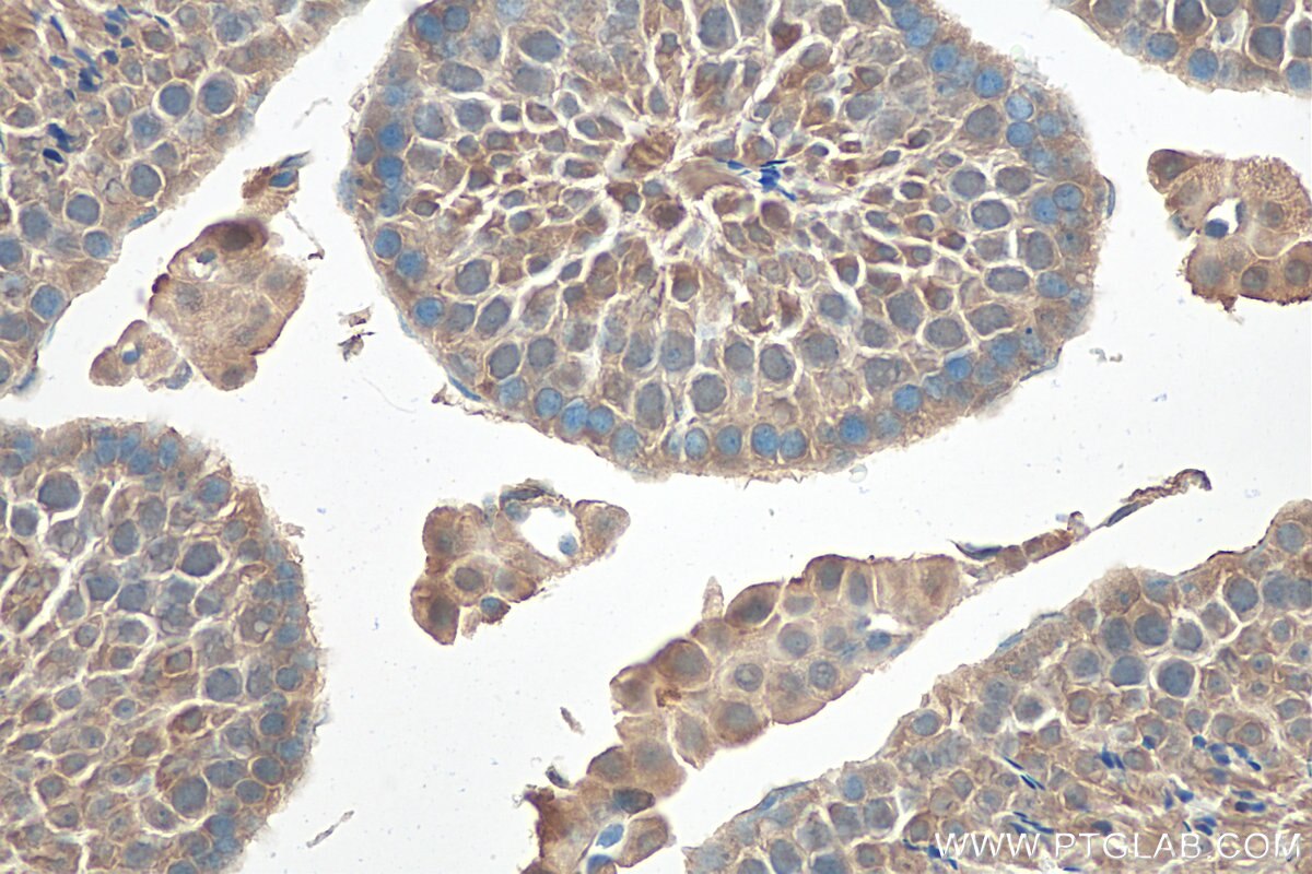 Immunohistochemistry (IHC) staining of mouse testis tissue using NME5 Polyclonal antibody (12923-1-AP)