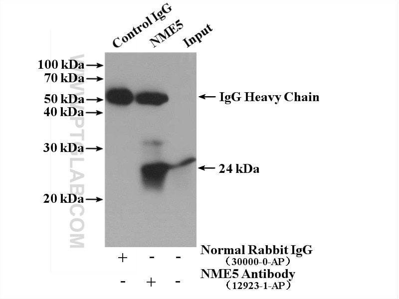 Immunoprecipitation (IP) experiment of mouse testis tissue using NME5 Polyclonal antibody (12923-1-AP)