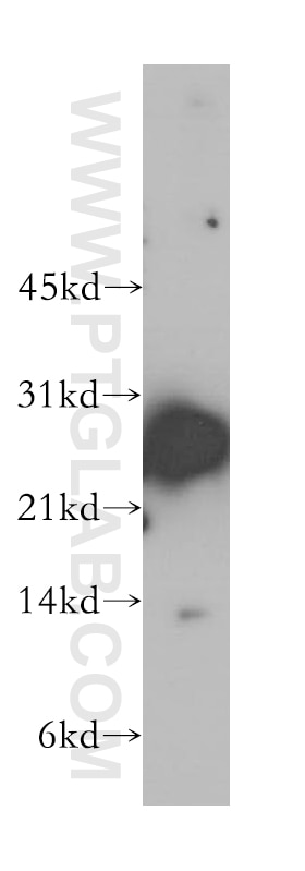 Western Blot (WB) analysis of human kidney tissue using NME5 Polyclonal antibody (12923-1-AP)