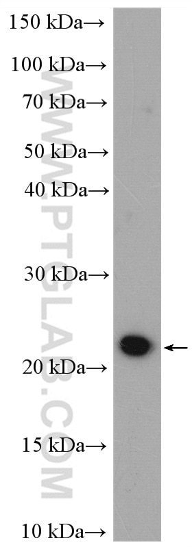 Western Blot (WB) analysis of LNCaP cells using NME6 Polyclonal antibody (10250-1-AP)