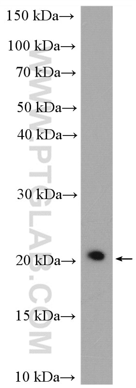 Western Blot (WB) analysis of U2OS cells using NME6 Polyclonal antibody (10250-1-AP)