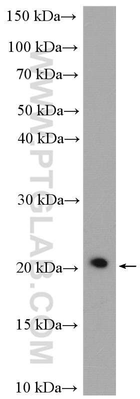 WB analysis of U2OS using 10250-1-AP