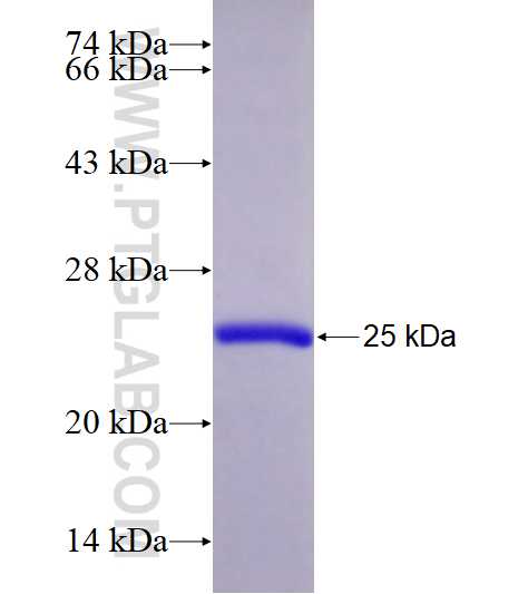 NME6 fusion protein Ag28670 SDS-PAGE