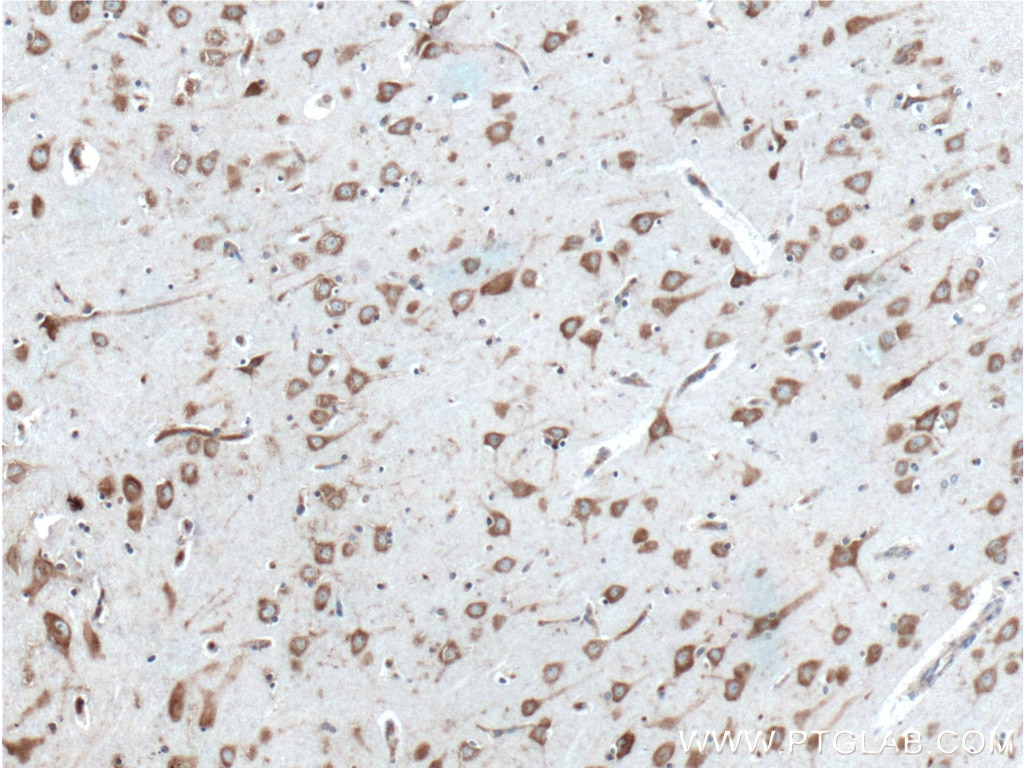 Immunohistochemistry (IHC) staining of human brain tissue using NME7 Polyclonal antibody (26449-1-AP)