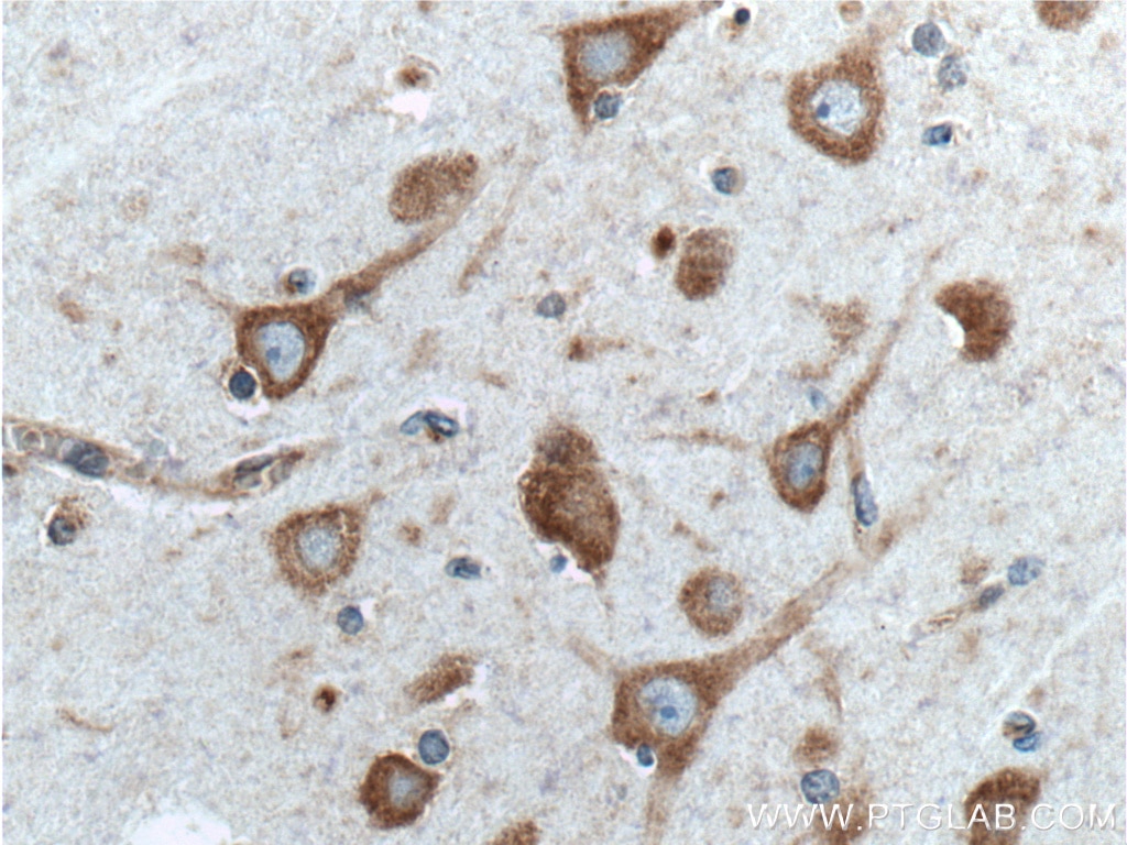 IHC staining of human brain using 26449-1-AP