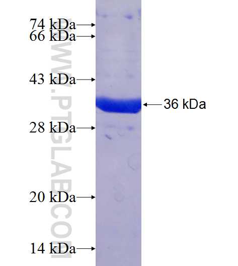 NME7 fusion protein Ag24918 SDS-PAGE