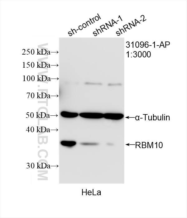Western Blot (WB) analysis of HeLa cells using NMI Polyclonal antibody (31096-1-AP)