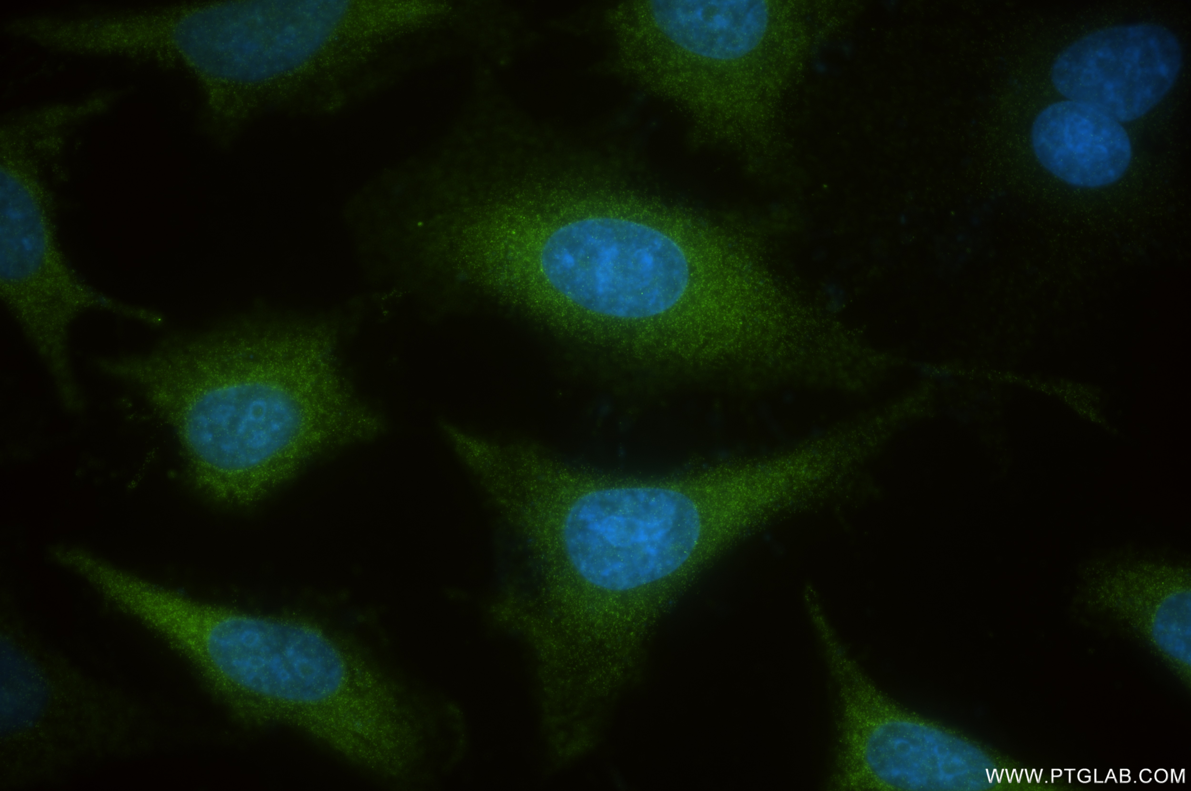 Immunofluorescence (IF) / fluorescent staining of HeLa cells using NMI Recombinant antibody (83986-5-RR)