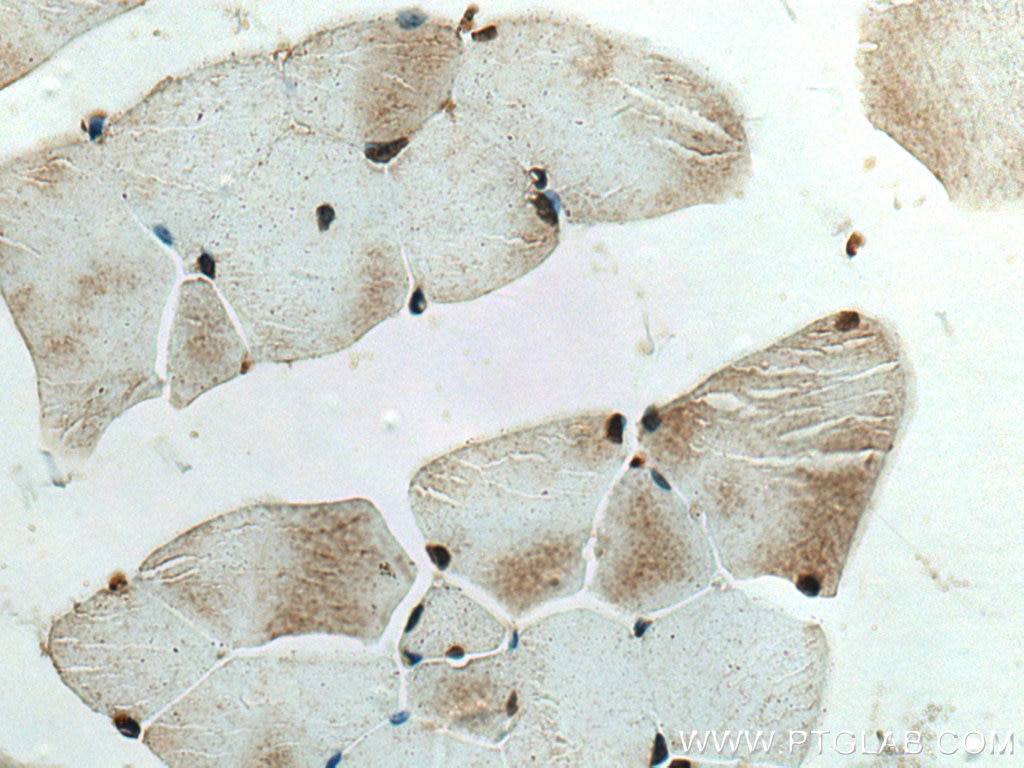 Immunohistochemistry (IHC) staining of mouse skeletal muscle tissue using NMNAT1 Polyclonal antibody (11399-1-AP)