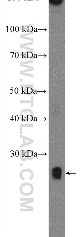 Western Blot (WB) analysis of pig heart tissue using NMNAT1 Polyclonal antibody (11399-1-AP)