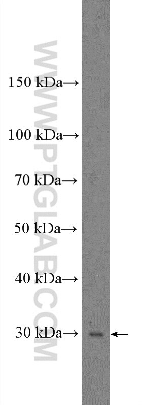 Western Blot (WB) analysis of mouse testis tissue using NMNAT1 Polyclonal antibody (11399-1-AP)