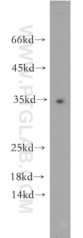 Western Blot (WB) analysis of human testis tissue using NMNAT1 Polyclonal antibody (11399-1-AP)