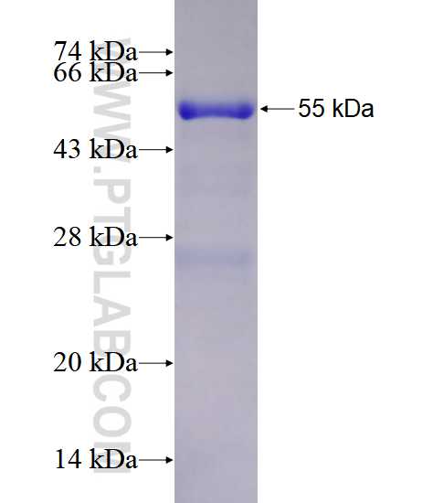 NMNAT1 fusion protein Ag1944 SDS-PAGE
