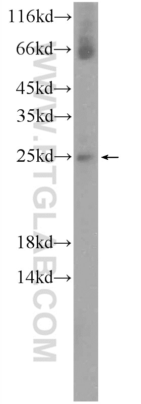 Western Blot (WB) analysis of mouse skeletal muscle tissue using NMNAT3 Polyclonal antibody (13236-1-AP)