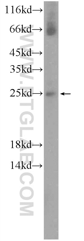 WB analysis of mouse skeletal muscle using 13236-1-AP