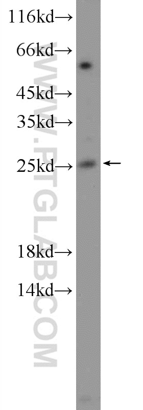 WB analysis of mouse kidney using 13236-1-AP