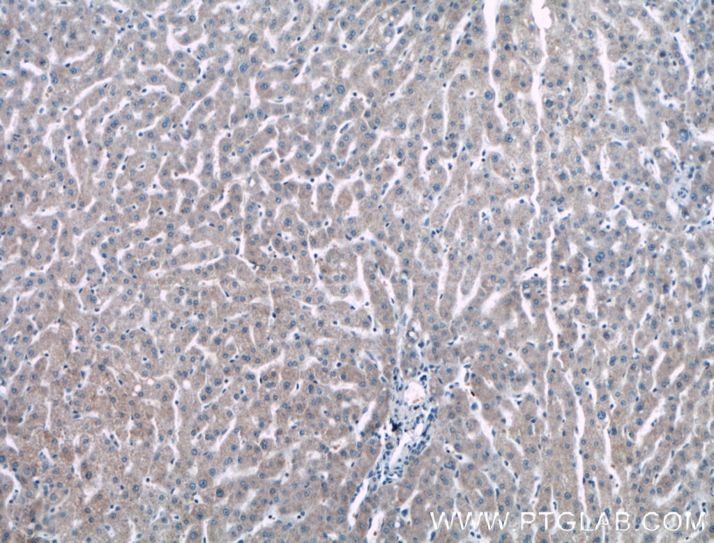 IHC staining of human liver using 15765-1-AP