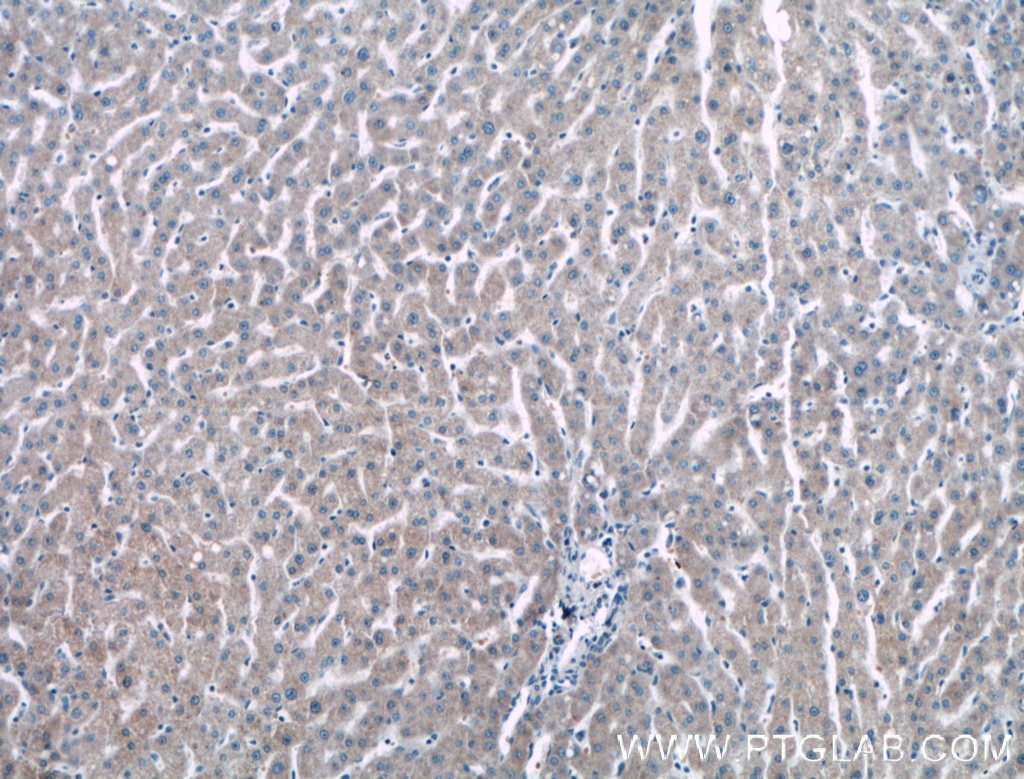 Immunohistochemistry (IHC) staining of human liver tissue using NMRAL1 Polyclonal antibody (15765-1-AP)