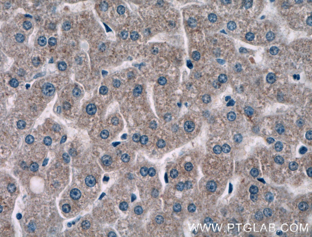 Immunohistochemistry (IHC) staining of human liver tissue using NMRAL1 Polyclonal antibody (15765-1-AP)
