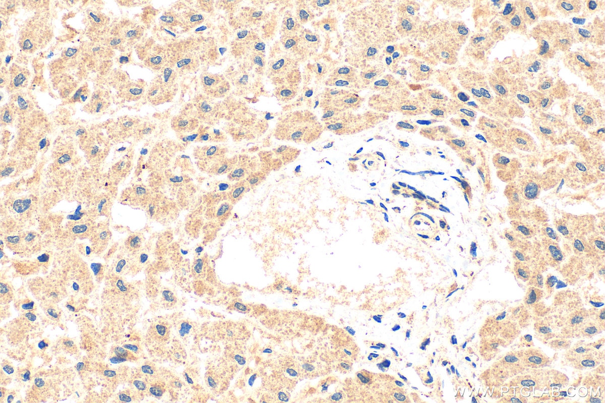 Immunohistochemistry (IHC) staining of human liver tissue using NMRAL1 Polyclonal antibody (15765-1-AP)