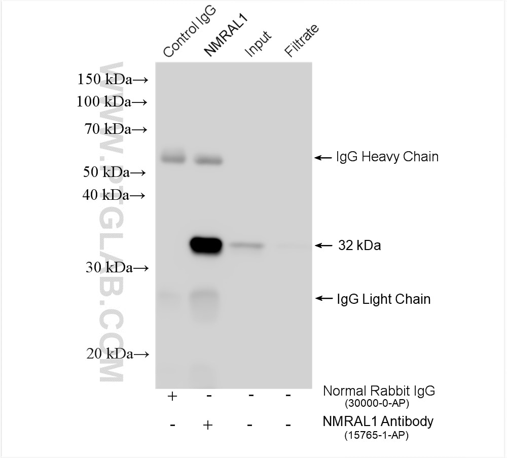 Immunoprecipitation (IP) experiment of Jurkat cells using NMRAL1 Polyclonal antibody (15765-1-AP)
