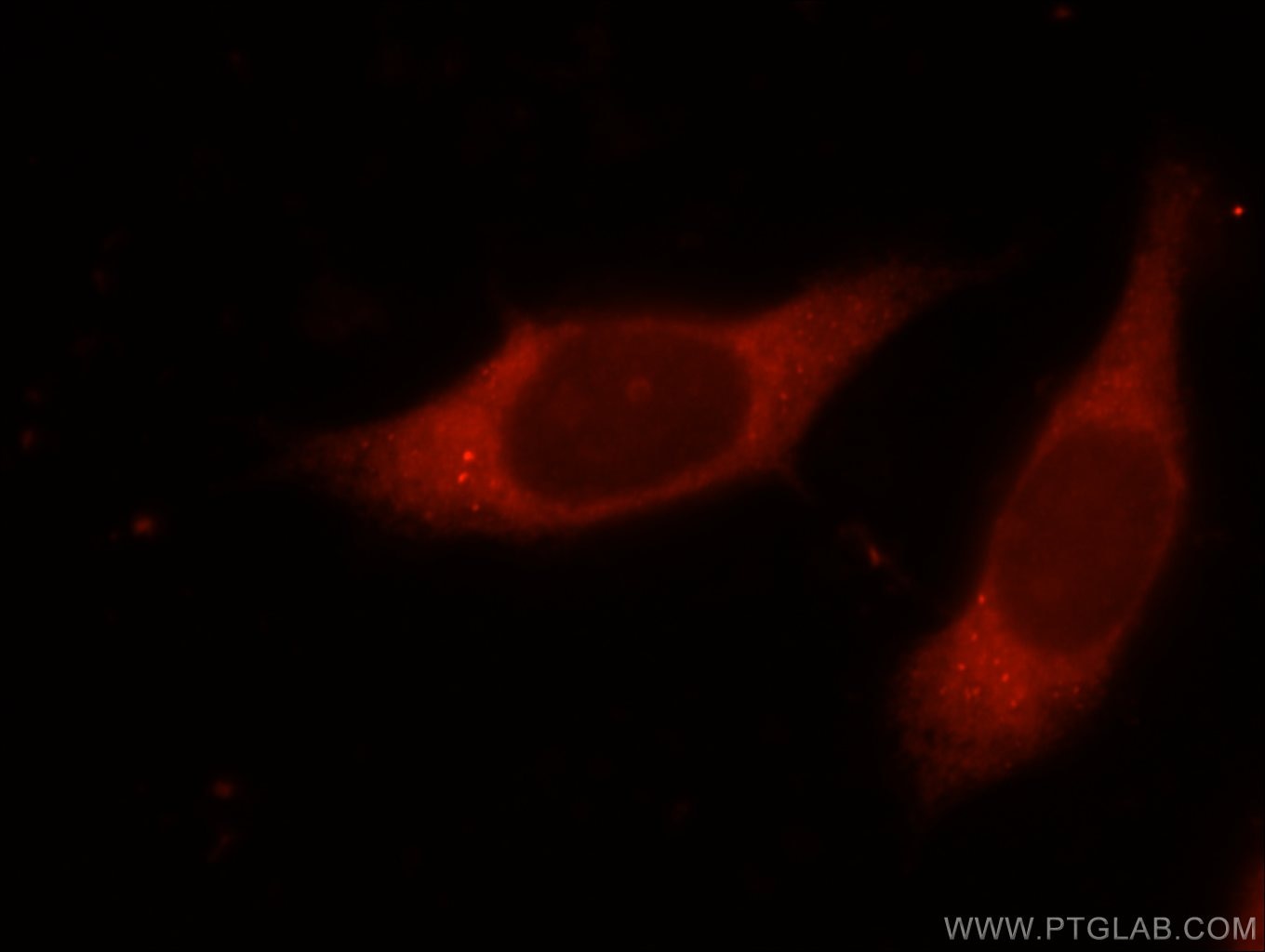 Immunofluorescence (IF) / fluorescent staining of MCF-7 cells using NMT1 Polyclonal antibody (11546-1-AP)