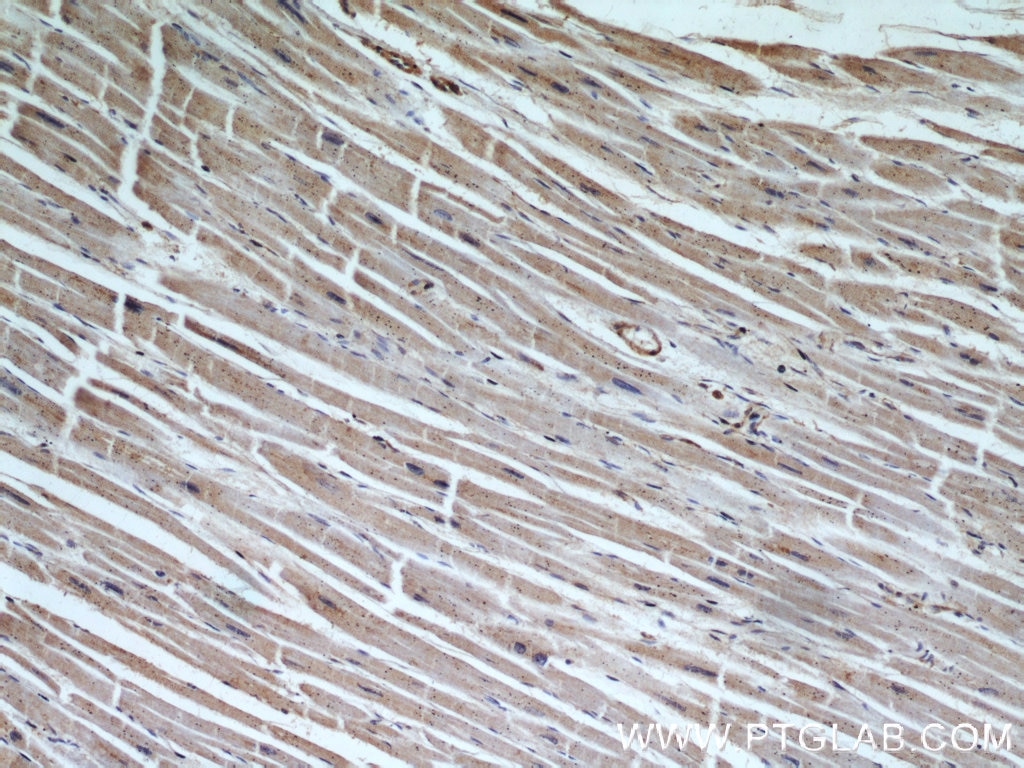 IHC staining of human heart using 11546-1-AP