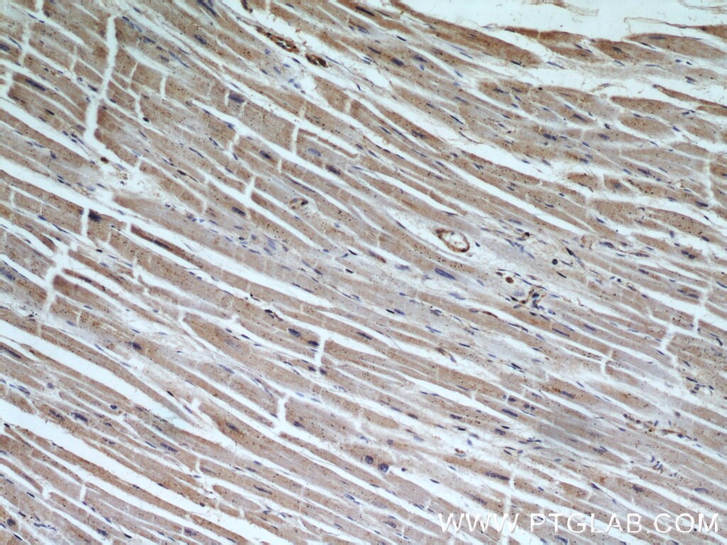 Immunohistochemistry (IHC) staining of human heart tissue using NMT1 Polyclonal antibody (11546-1-AP)