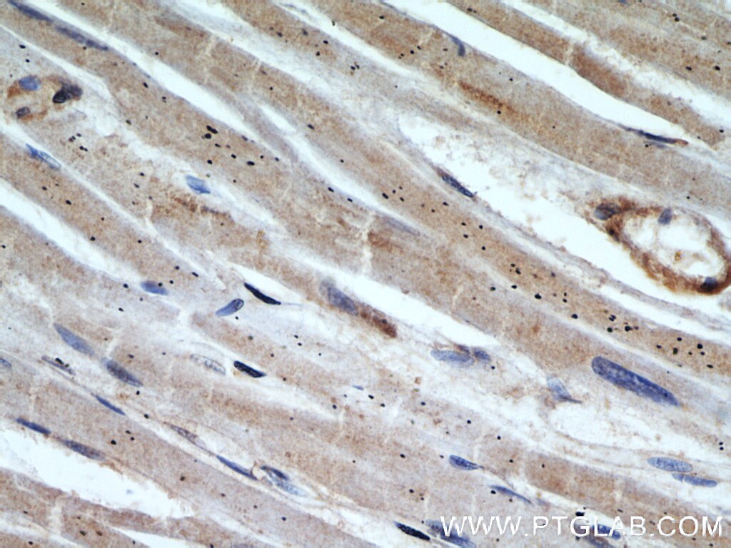 Immunohistochemistry (IHC) staining of human heart tissue using NMT1 Polyclonal antibody (11546-1-AP)