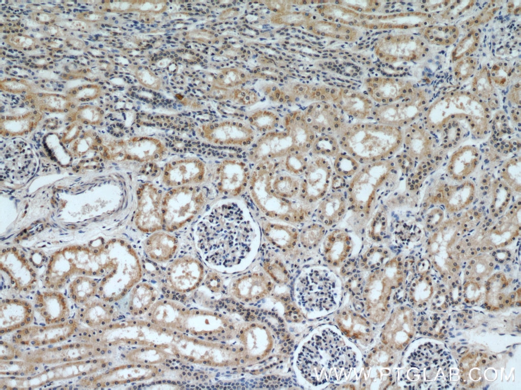 Immunohistochemistry (IHC) staining of human kidney tissue using NMT1 Polyclonal antibody (11546-1-AP)