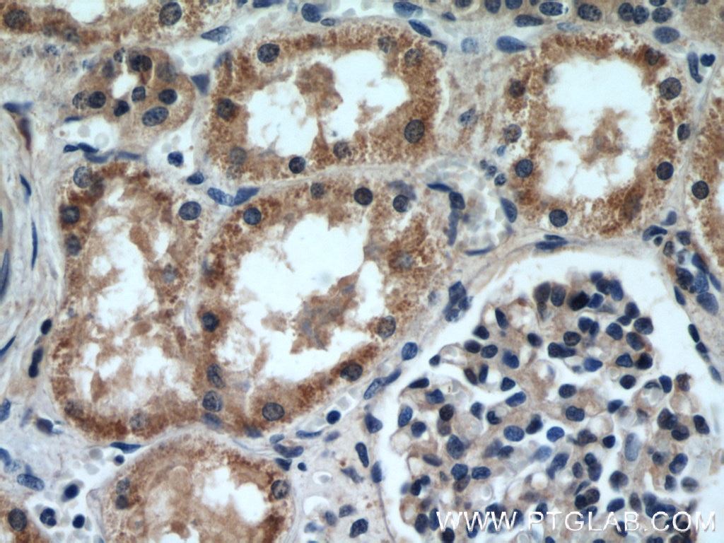 Immunohistochemistry (IHC) staining of human kidney tissue using NMT1 Polyclonal antibody (11546-1-AP)