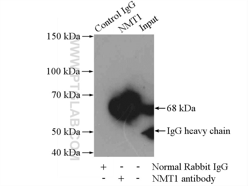 Immunoprecipitation (IP) experiment of HeLa cells using NMT1 Polyclonal antibody (11546-1-AP)