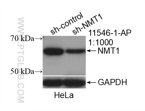 Western Blot (WB) analysis of HeLa cells using NMT1 Polyclonal antibody (11546-1-AP)