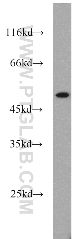 Western Blot (WB) analysis of mouse pancreas tissue using NMT1 Polyclonal antibody (11546-1-AP)