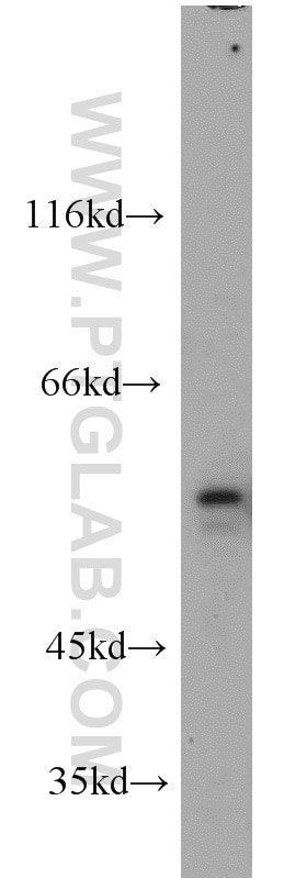 Western Blot (WB) analysis of HeLa cells using NMT1 Polyclonal antibody (11546-1-AP)