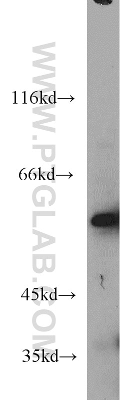 Western Blot (WB) analysis of L02 cells using NMT1 Polyclonal antibody (11546-1-AP)