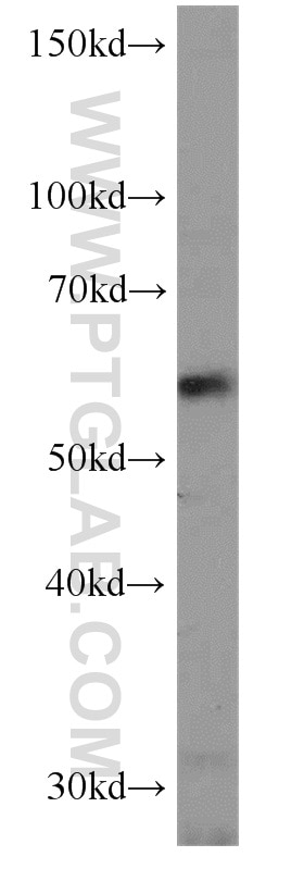 Western Blot (WB) analysis of PC-3 cells using NMT1 Polyclonal antibody (11546-1-AP)