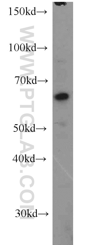 Western Blot (WB) analysis of SKOV-3 cells using NMT1 Polyclonal antibody (11546-1-AP)