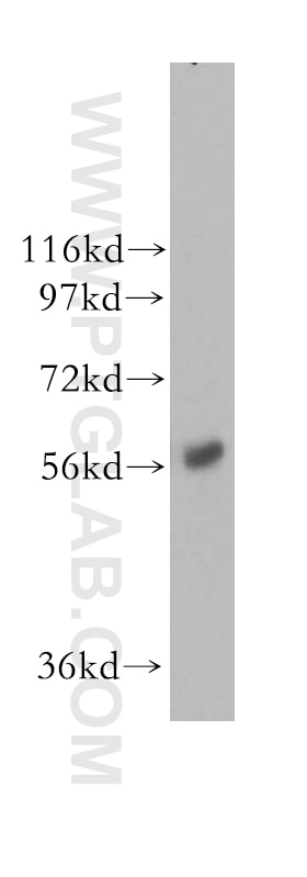 Western Blot (WB) analysis of human kidney tissue using NMT1 Polyclonal antibody (11546-1-AP)