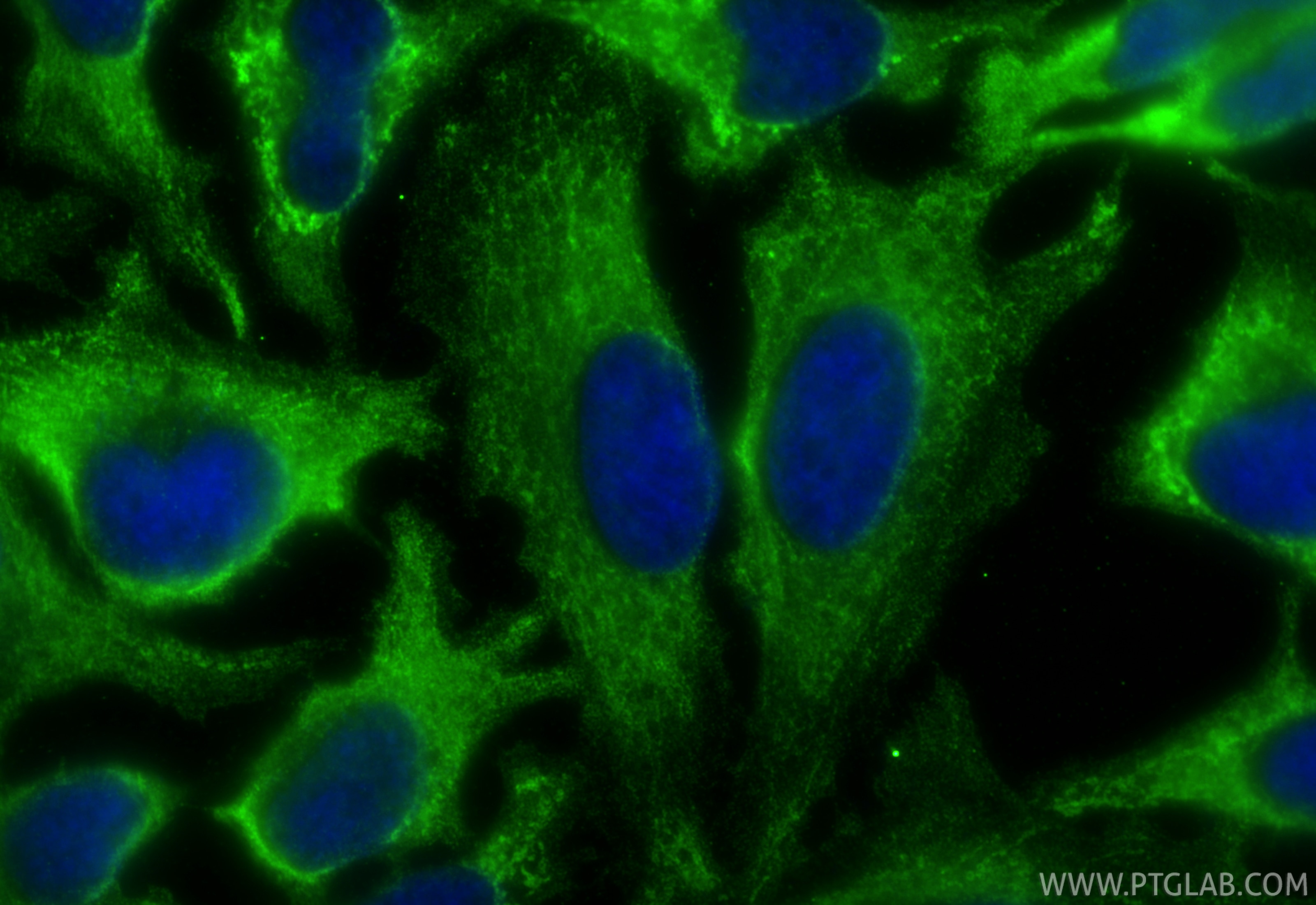 Immunofluorescent analysis of (-20°C Ethanol) fixed HeLa cells using NMT1 antibody (67984-1-Ig, Clone: 2D9B9 ) at dilution of 1:800 and CoraLite®488-Conjugated Goat Anti-Mouse IgG(H+L) (SA00013-1). Immunofluorescence (IF) / fluorescent staining of HeLa cells using NMT1 Monoclonal antibody (67984-1-Ig)
