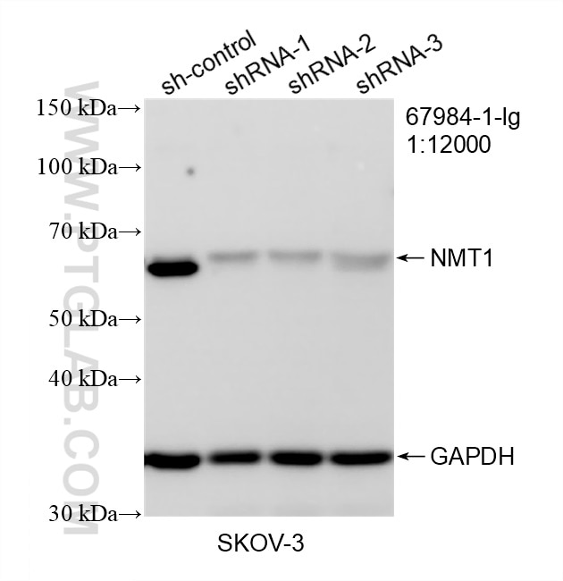 Western Blot (WB) analysis of SKOV-3 cells using NMT1 Monoclonal antibody (67984-1-Ig)