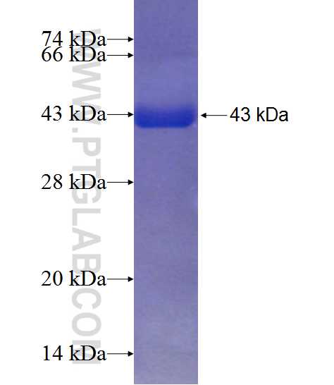NMT1 fusion protein Ag20541 SDS-PAGE