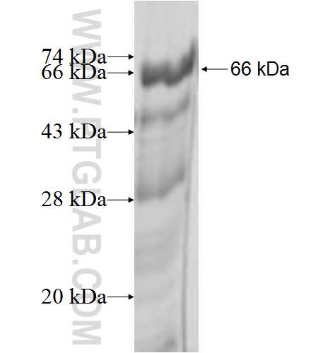 NMT1 fusion protein Ag2072 SDS-PAGE
