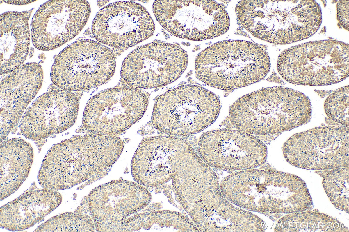 Immunohistochemistry (IHC) staining of mouse testis tissue using NMT2 Polyclonal antibody (15720-1-AP)