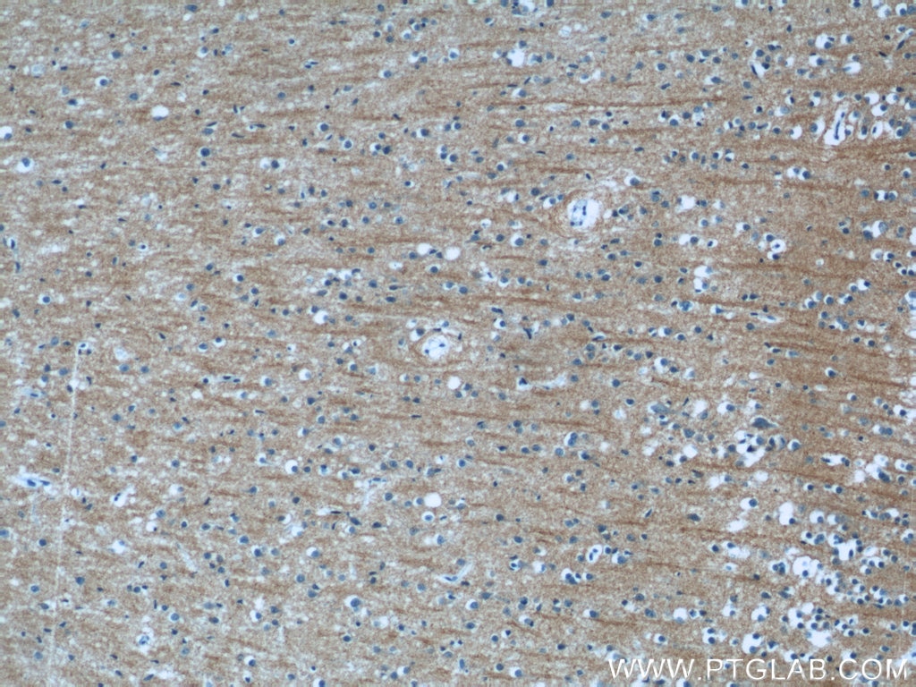 Immunohistochemistry (IHC) staining of human brain tissue using NMU Polyclonal antibody (24862-1-AP)