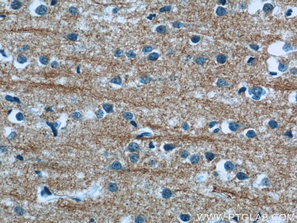 Immunohistochemistry (IHC) staining of human brain tissue using NMU Polyclonal antibody (24862-1-AP)