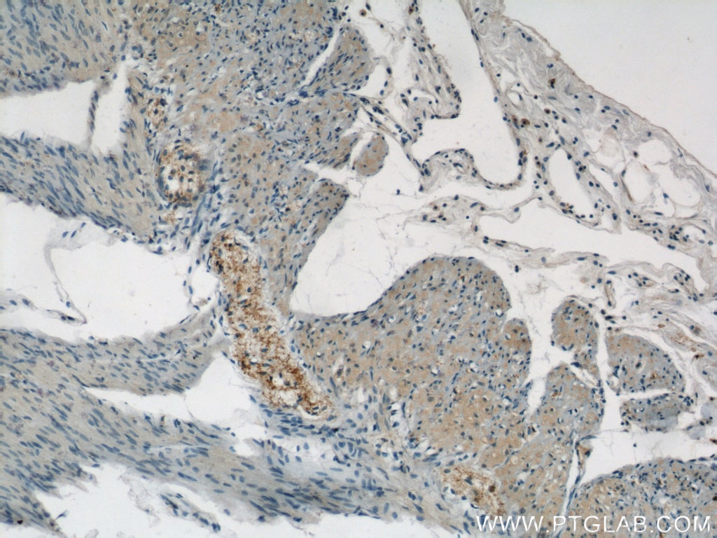 Immunohistochemistry (IHC) staining of human small intestine tissue using NMU Polyclonal antibody (24862-1-AP)
