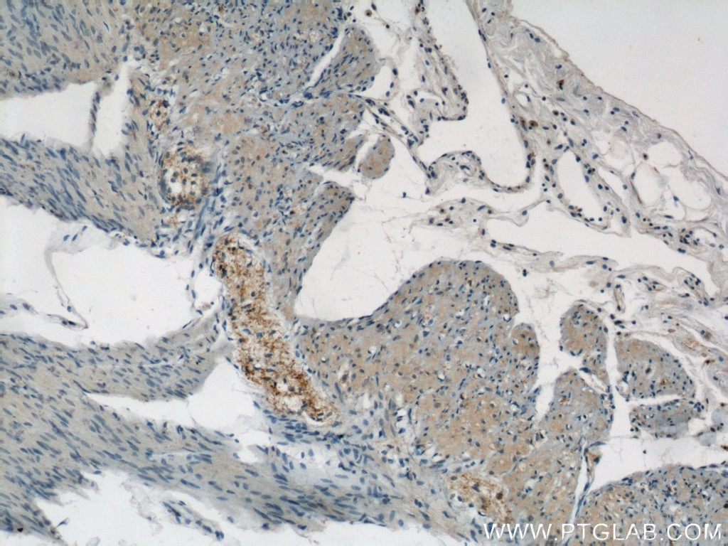 IHC staining of human small intestine using 24862-1-AP